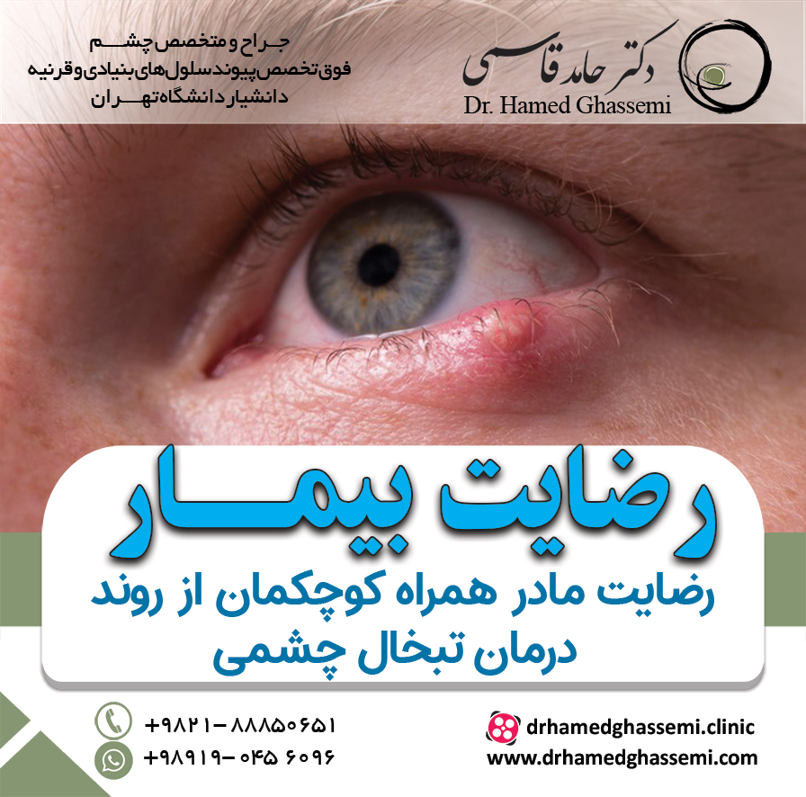 رضایت مادر همراه کوچک از روند درمان تبخال چشمی 
